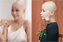 nu sinh mac ung thu hanh phuc khi nhan duoc thu cua thu tuong nguyen xuan phuc