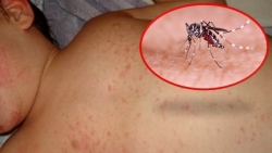 Các nước châu Á đối phó với dịch sốt xuất huyết bùng phát bất thường