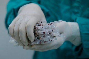 nhieu lo vaccine covid 19 se lui thoi gian ve viet nam