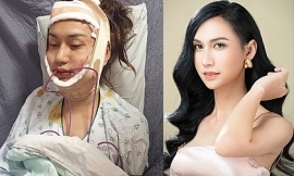 ca sy lynk lee la ai ten that la gi